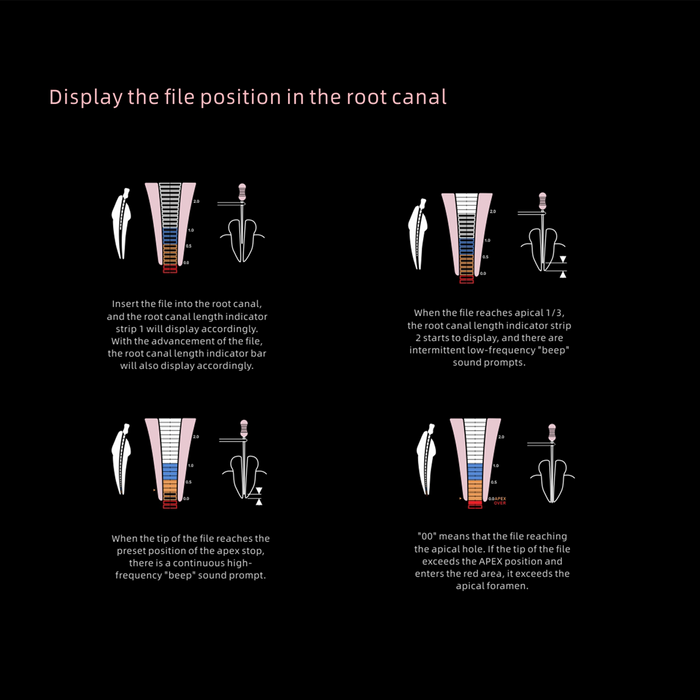 Woodpecker Woodpex V Apex Locator Connectable Endo Motor - JMU DENTAL INC