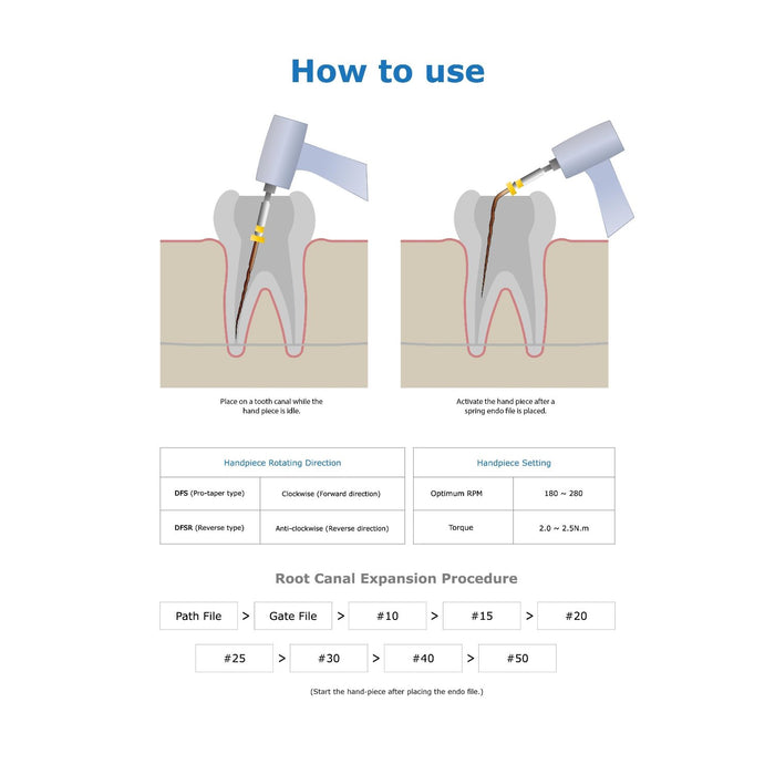 JMU NiTi Flexible Files Root Canal Intrument - JMU DENTAL INC