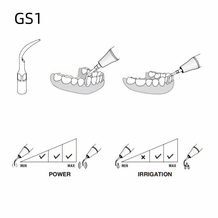 Woodpecker GS1 Ultrasonic Scaler Tips 5pcs/Set