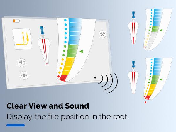 COXO Apex Locator, TFT-LCD Color Touch Screen, Can Preset Apical Stop. #C-ROOT I+ - JMU Dental